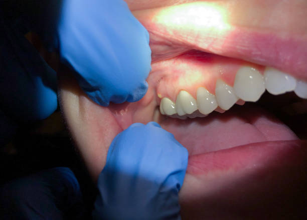 Best Holiday Emergency Dentist in Harrington Park, NJ