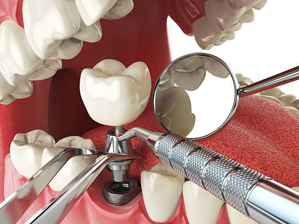 Best Emergency Dentist for Special Needs Patients in Harrington Park, NJ